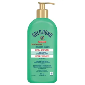 Gold Bond Extra-Strength Body Lotion with 3X Anti-Itch Relief, Aloe Vera & Vitamin E